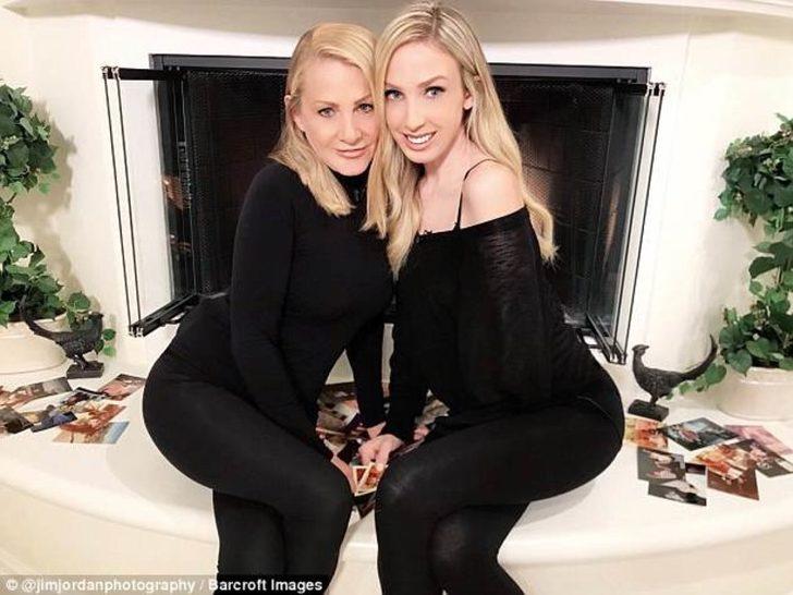 Doğum lekesi sandığı iz ikizi çıktı!  Meğer yıllardır bedeninde taşıyormuş G5