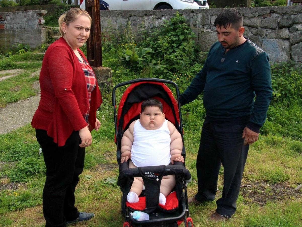 5 yaşında 90 kiloydu! Yağız ın inanılmaz değişimi 2