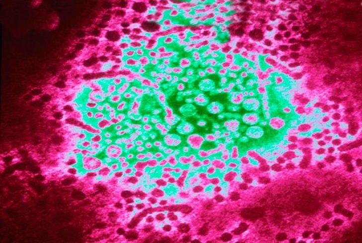 Bu buluş tıp tarihini değiştirecek! Gerçeği 4500 yıllık kalıntılar ortaya çıkardı G5