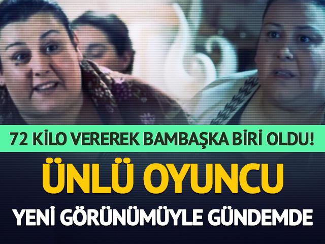 72 kilo vererek bambaşka biri oldu! Son halini paylaştı  