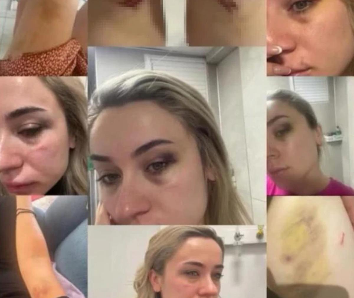 Elif &ouml;ğretmen şiddeti paylaştı, ağabeyi eski enişteyi saha ortasında tekme tokat d&ouml;vd&uuml; 1