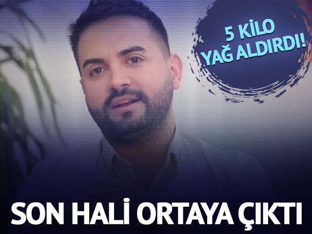 5 kilo yağ aldırdı! Son hali ortaya &ccedil;ıktı