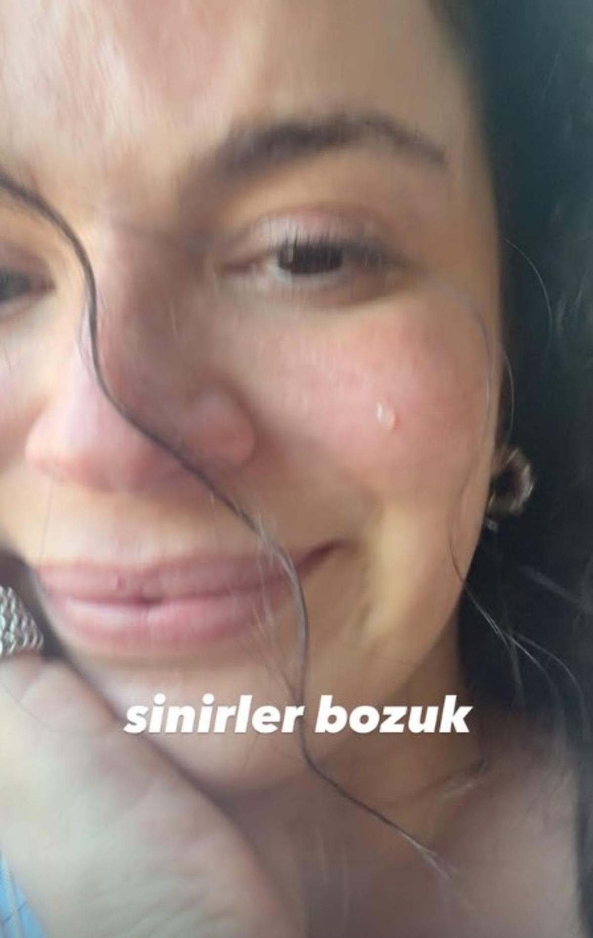 Doktor hatası hayatını kabusa &ccedil;evirdi! Aslı Bekiroğlu nun başına gelmeyen kalmadı  2