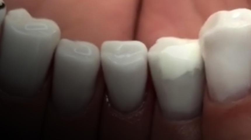 'Daha ne olabilir ki?' diye düşünmeyin! Bu da moda oldu