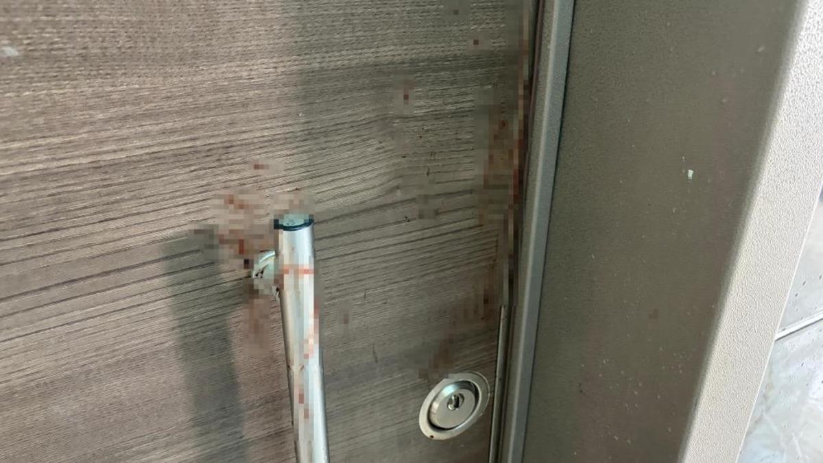 Ankara&rsquo;da bı&ccedil;aklı saldırıda yaralanan aynı aileden 4 kişinin tedavisi s&uuml;r&uuml;yor 1