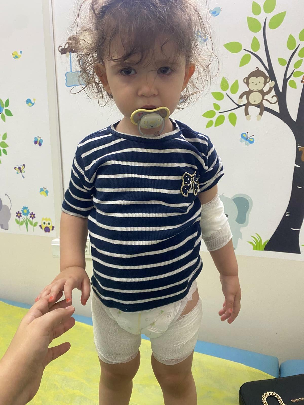Restorandaki tereyağı şovu kötü bitti! 2 yaşındaki bebek yandı 1
