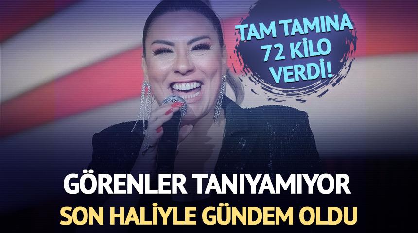 Tam tamına 72 kilo verdi! G&ouml;renler tanıyamıyor