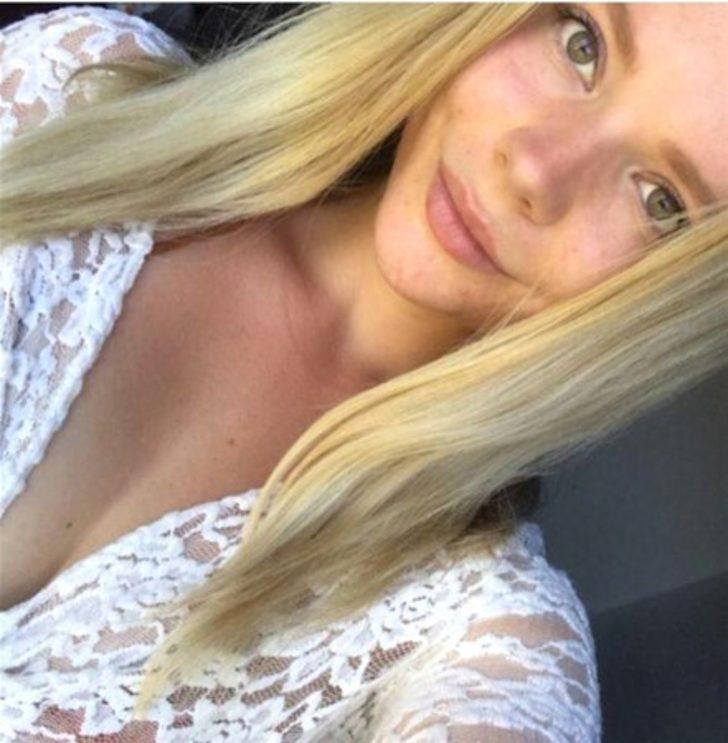 Bakın aknelerinden nasıl kurtulmuş G2