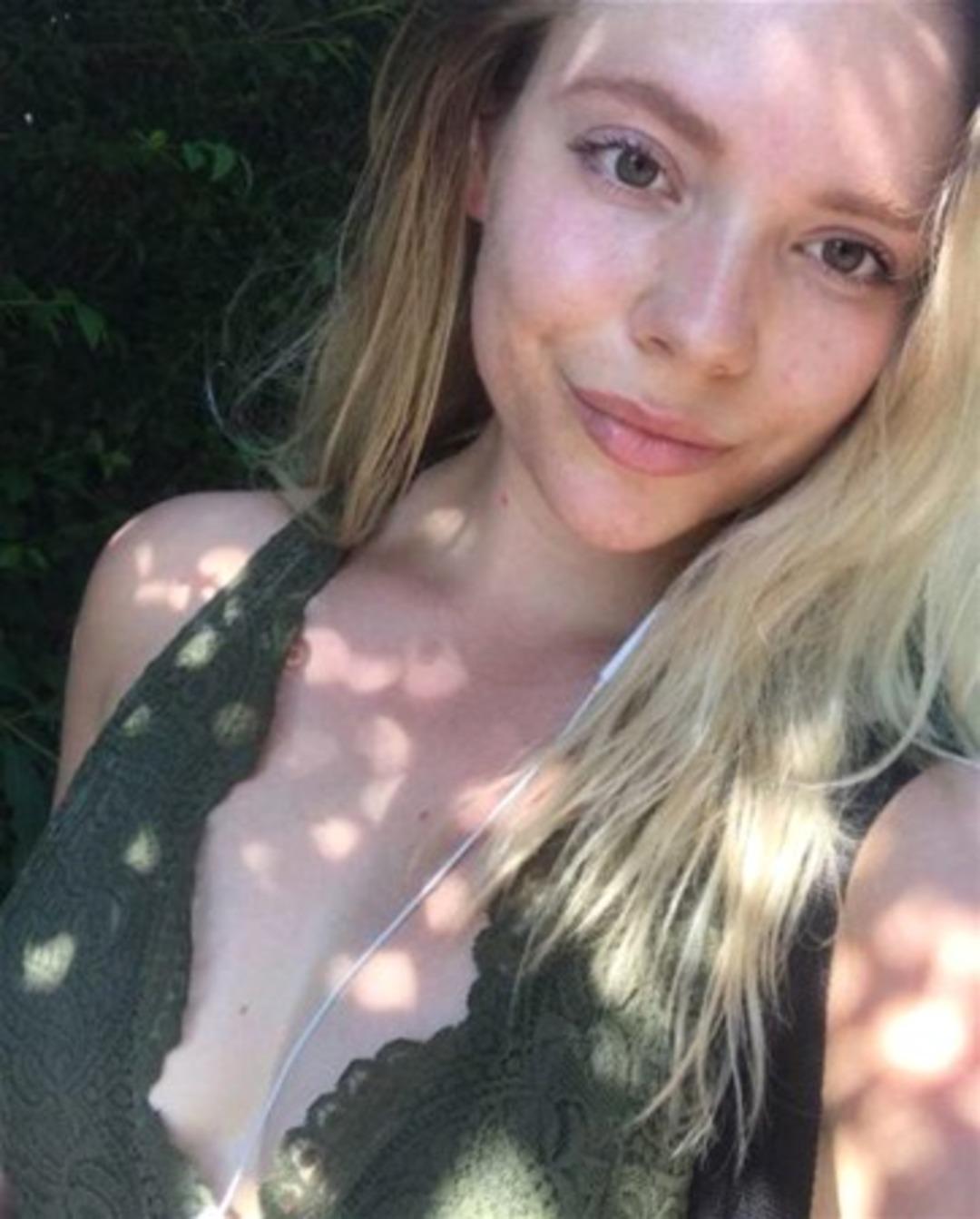 Bakın aknelerinden nasıl kurtulmuş