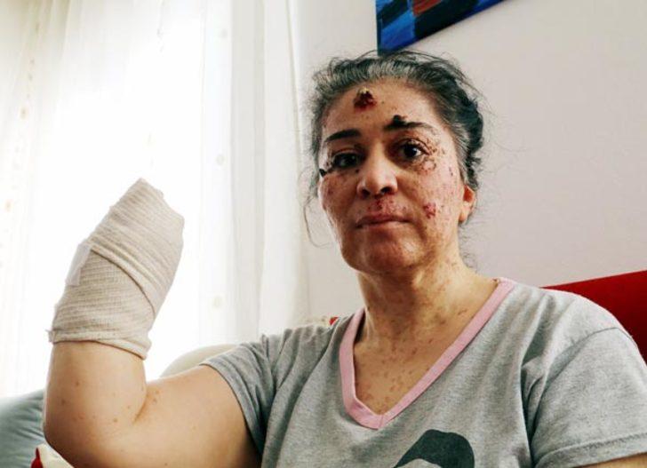 Güneşin erittiği kadın organlarını bir bir kaybediyor G2