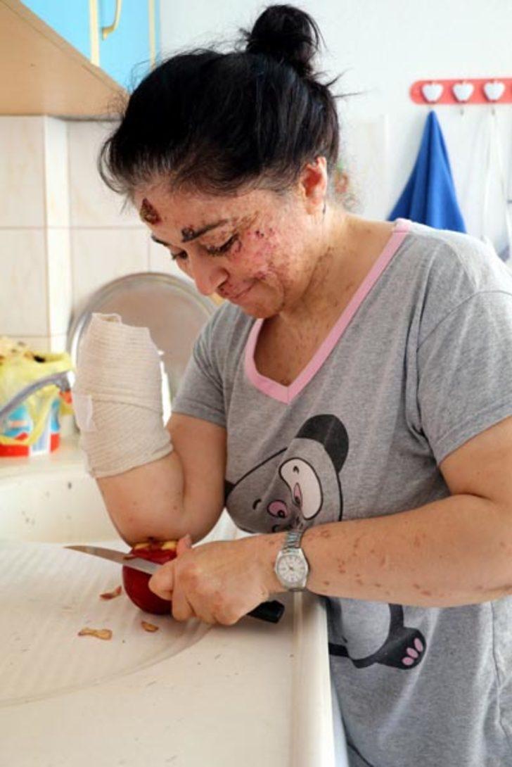 Güneşin erittiği kadın organlarını bir bir kaybediyor G5