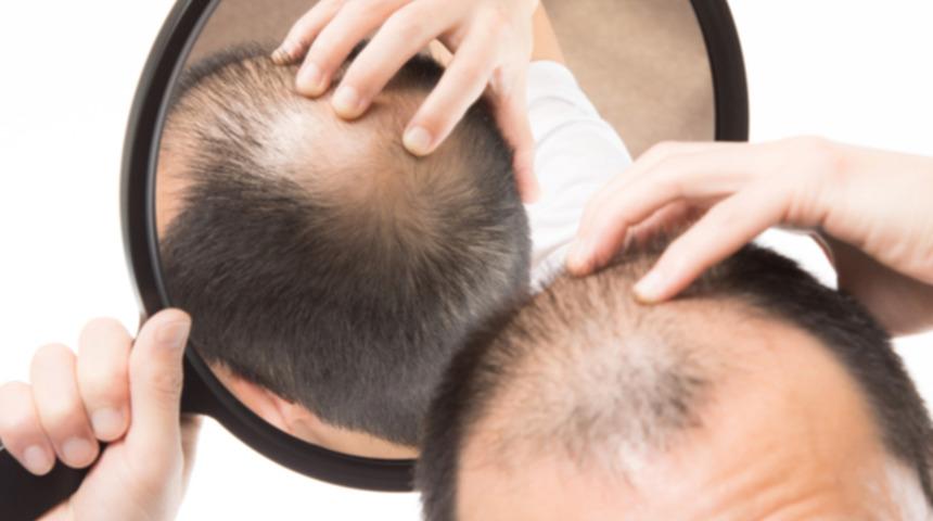 Sa&ccedil;larınızın elinizden kayıp gitmesine izin vermeyin!