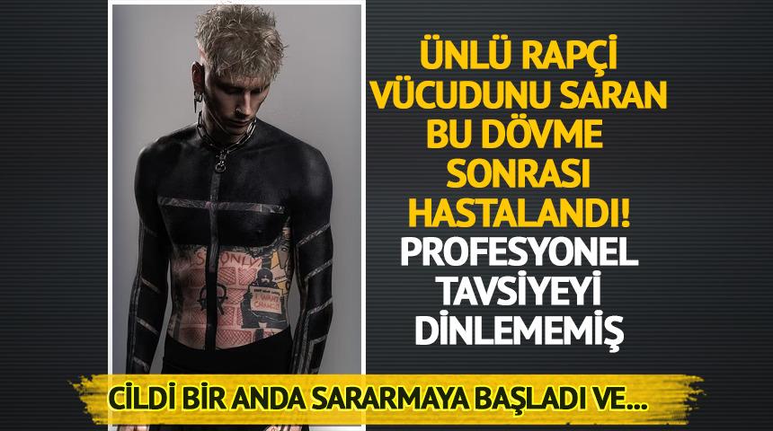 &Uuml;nl&uuml; rap&ccedil;i v&uuml;cudunu saran d&ouml;vme y&uuml;z&uuml;nden zor g&uuml;nler ge&ccedil;irdi
