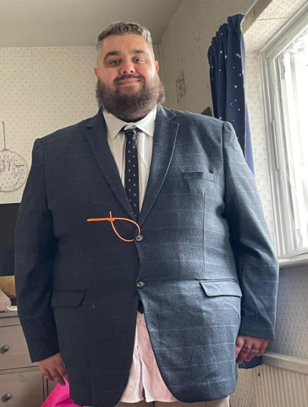 Tek bir aktivite yaptı 89 kilo verdi! İlham veren dönüşüm hikayesi 3