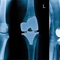 Protezlerinizle yere daha sağlam basın!