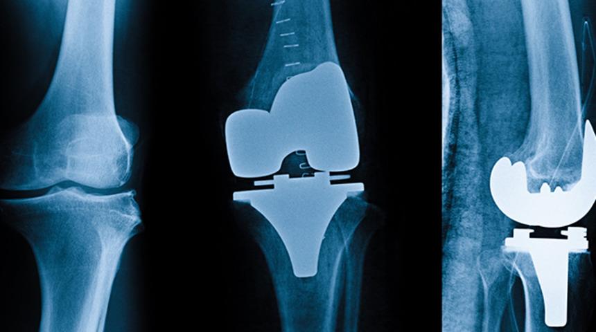 Protezlerinizle yere daha sağlam basın!