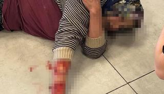 Afyonkarahisar'da dehşet! K&ouml;pek, kadının kolunu par&ccedil;aladı