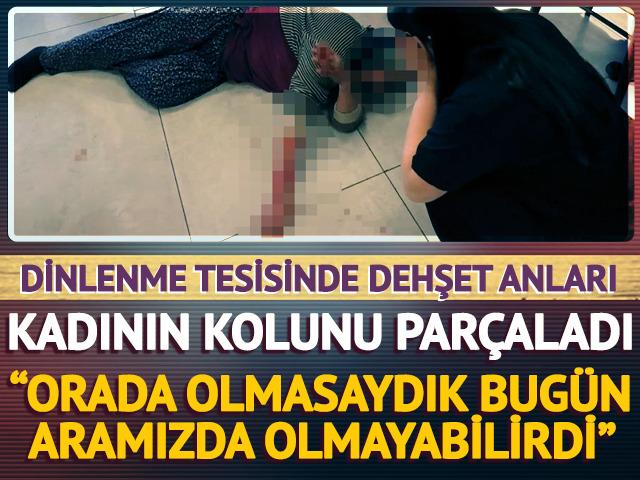 Afyonkarahisar'da dehşet! K&ouml;pek, kadının kolunu par&ccedil;aladı