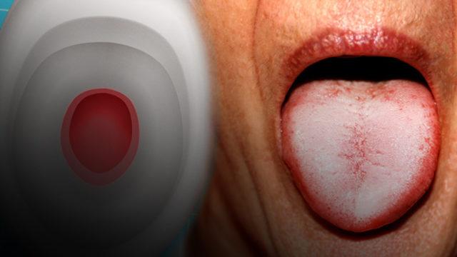 Demir eksiliğinin 10 belirtisi