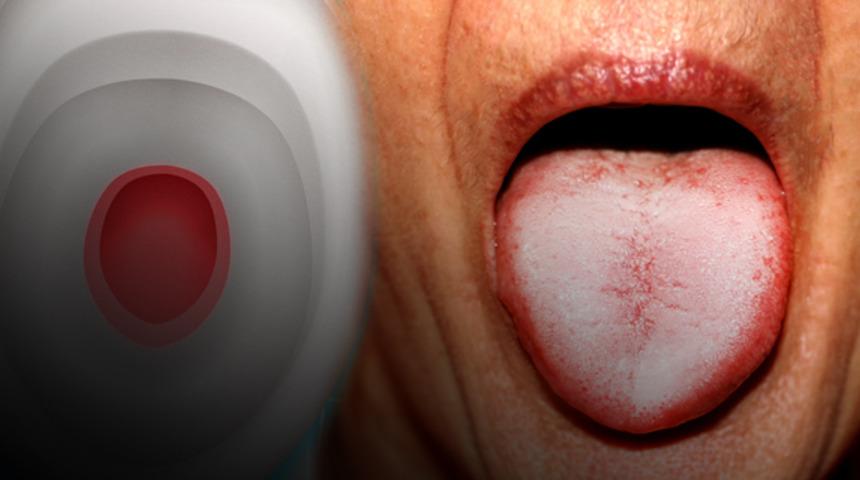 Demir eksiliğinin 10 belirtisi