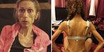 Anoreksiya hastası 10 kadının son halleri bomba!