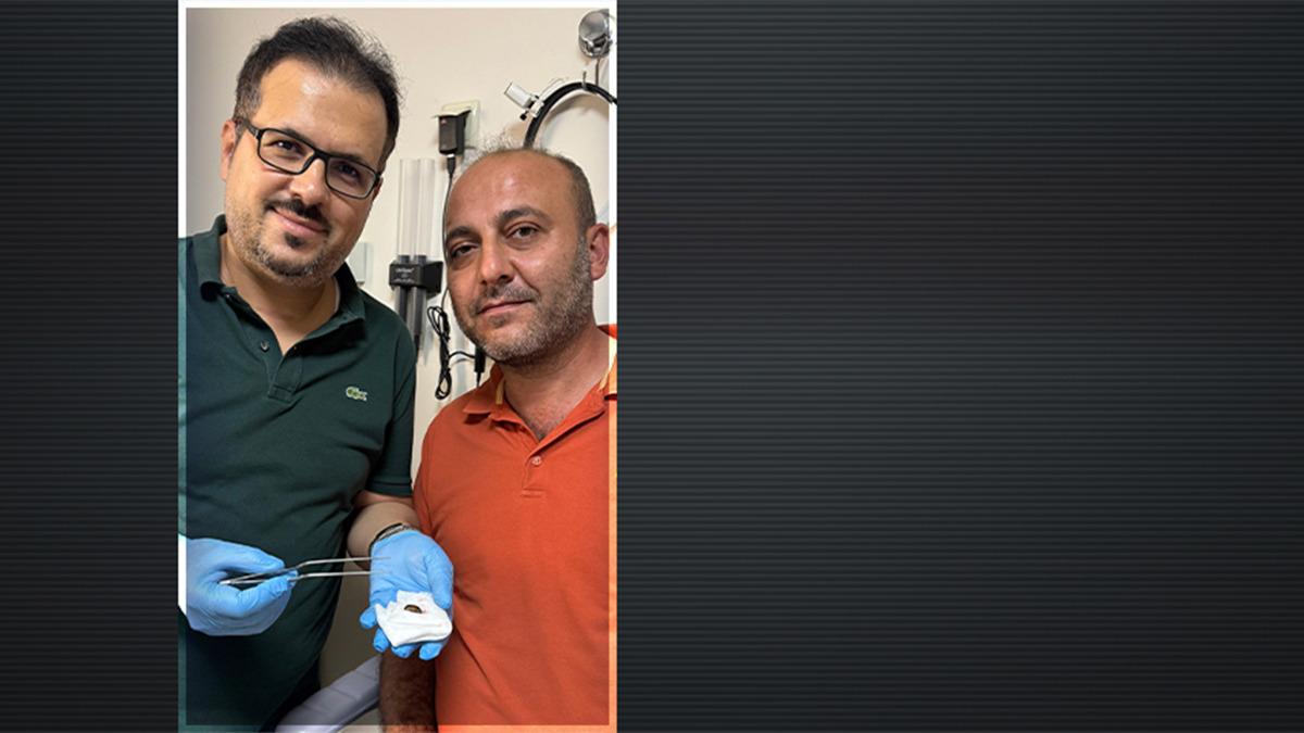 İşitme kaybı nedeniyle hastaneye gitti: Kulağından çıkan şaşırttı
