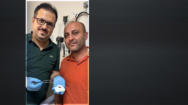 İşitme kaybı nedeniyle hastaneye gitti: Kulağından çıkan şaşırttı