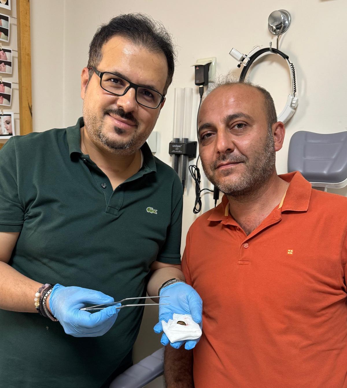 İşitme kaybı nedeniyle hastaneye gitti: Kulağından &ccedil;ıkan şaşırttı 2