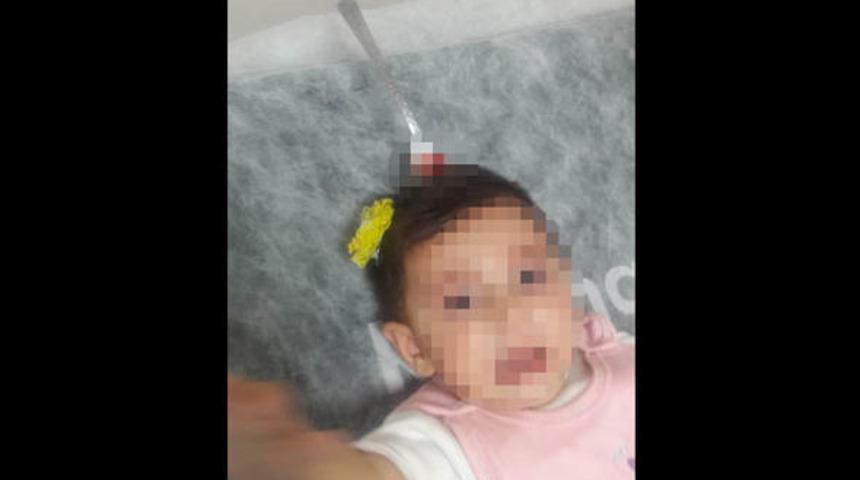İzmir'in Torbalı ilçesinde doktorları bile şoke eden olay! 8 aylık bebeğin kafasına çatal saplandı