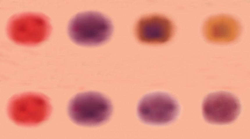  V&uuml;cudunuzda oluşan &ccedil;&uuml;r&uuml;kler ne anlama geliyor?