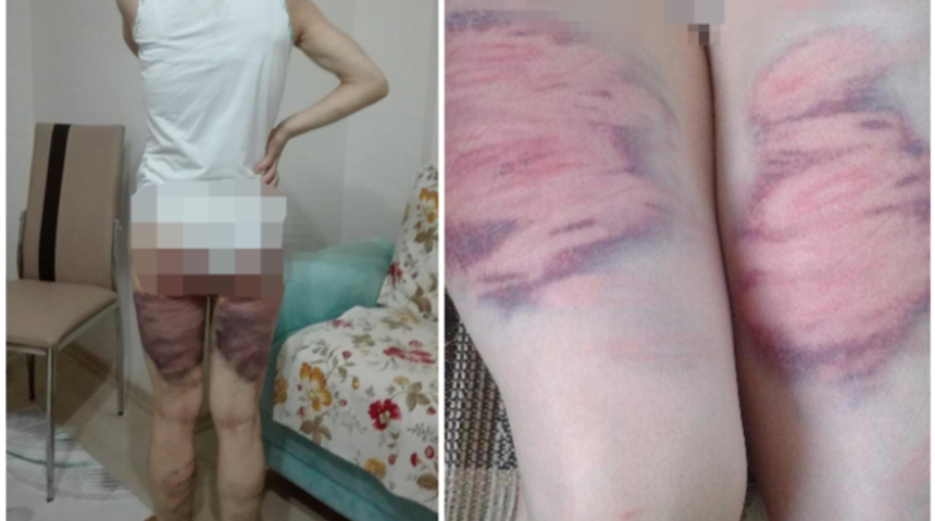 Eşine oklava ve kemerle işkence yaptı, serbest kaldı