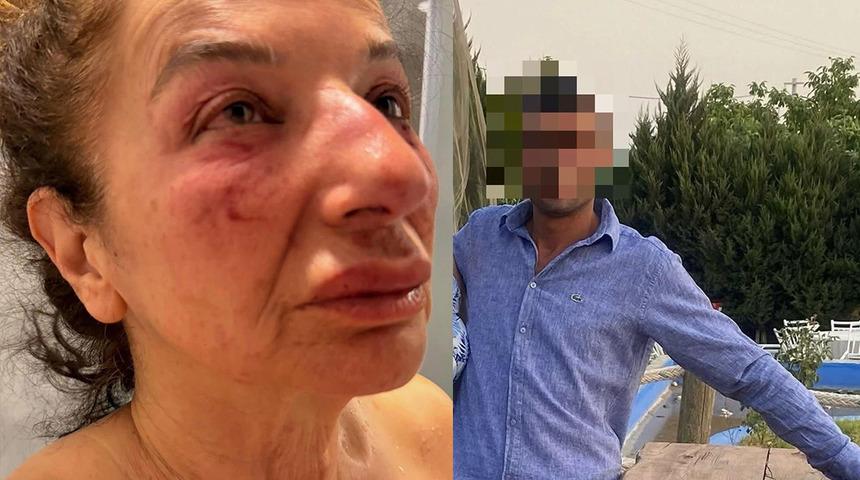 Yardım bahanesiyle eczacı kadını &ccedil;ağırdı! Kemerle boğmaya &ccedil;alıştı