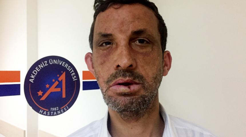 Uğur Acar'ın son hali şoke etti