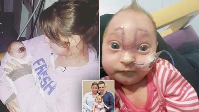 Beyni dışarıda doğdu! Şimdi ise... 