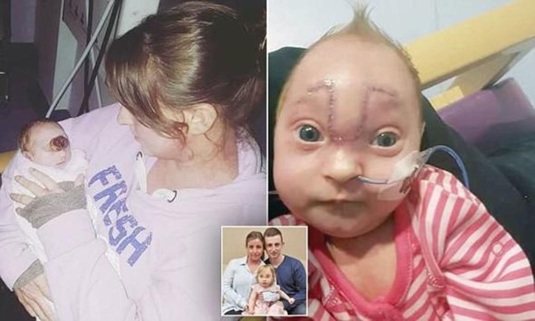 Beyni dışarıda doğdu! Şimdi ise... 