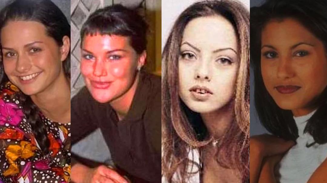 Hollywood yanağı yaptırıp bambaşka birine d&ouml;n&uuml;şen &uuml;nl&uuml;ler