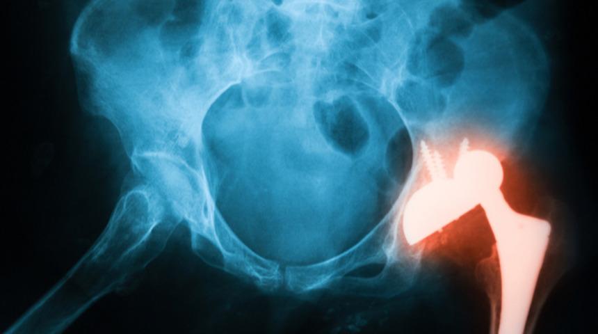 Doğumsal kal&ccedil;a &ccedil;ıkığı ger&ccedil;ekten doğumsal bir hastalık mıdır? 