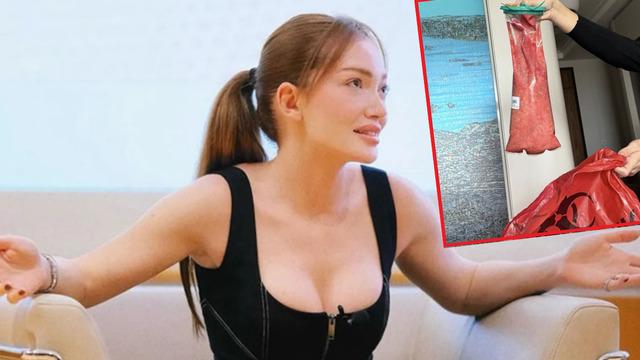 Acil ameliyata alınmıştı! Danla Bilic korkunç olayı anlattı: 'Dikişlerimden dolgu akıyordu'
