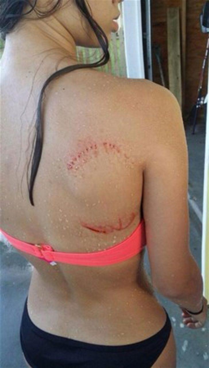 Felaketin kıyısından dönen insanlar  G1