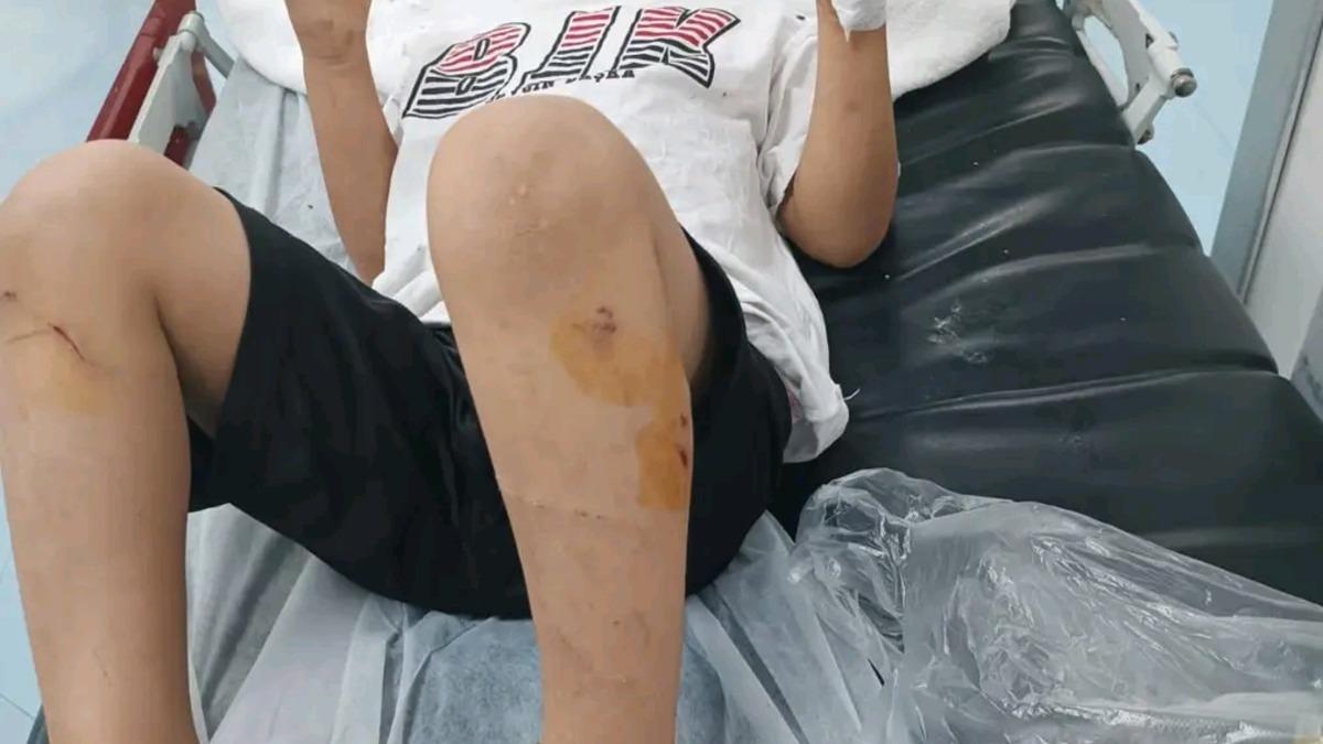 Sokak köpeklerinin saldırısına uğrayan Abdulkadir, yaralandı