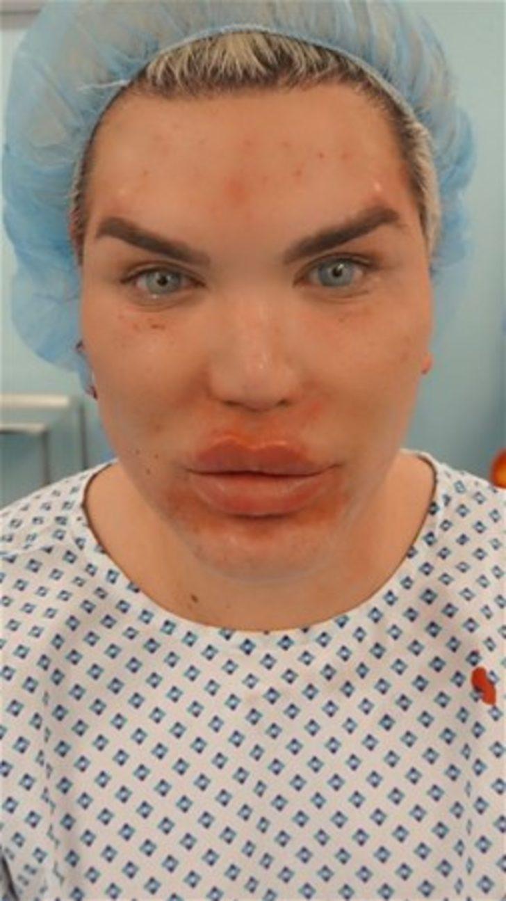 Durmak nedir bilmiyor. doktorlar onu uyarmıştı! G1