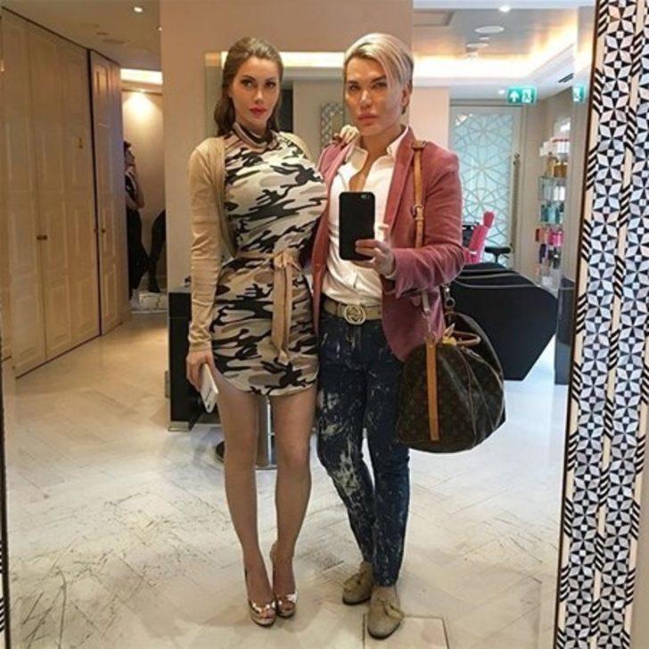 Doktorlar uyardı ama o bir kez daha ameliyat masasına yattı! İşte son hali G1