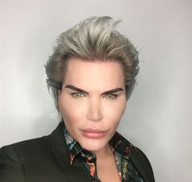 Doktorlar uyardı ama o bir kez daha ameliyat masasına yattı! İşte son hali G2