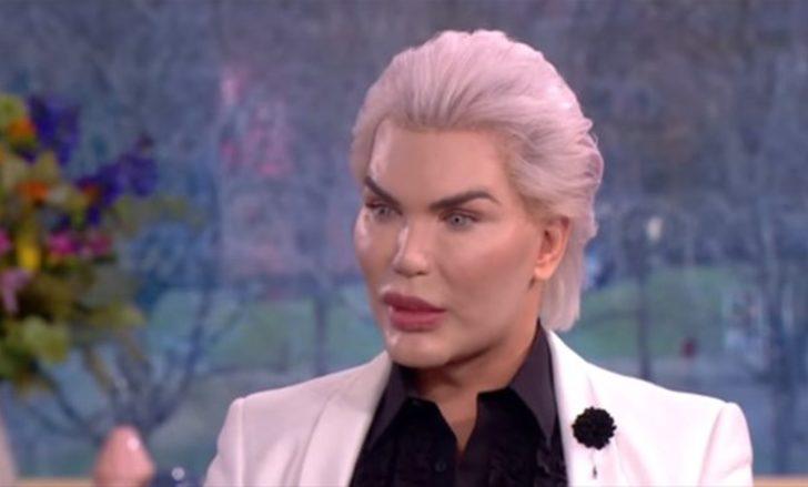 Doktorlar uyardı ama o bir kez daha ameliyat masasına yattı! İşte son hali G4