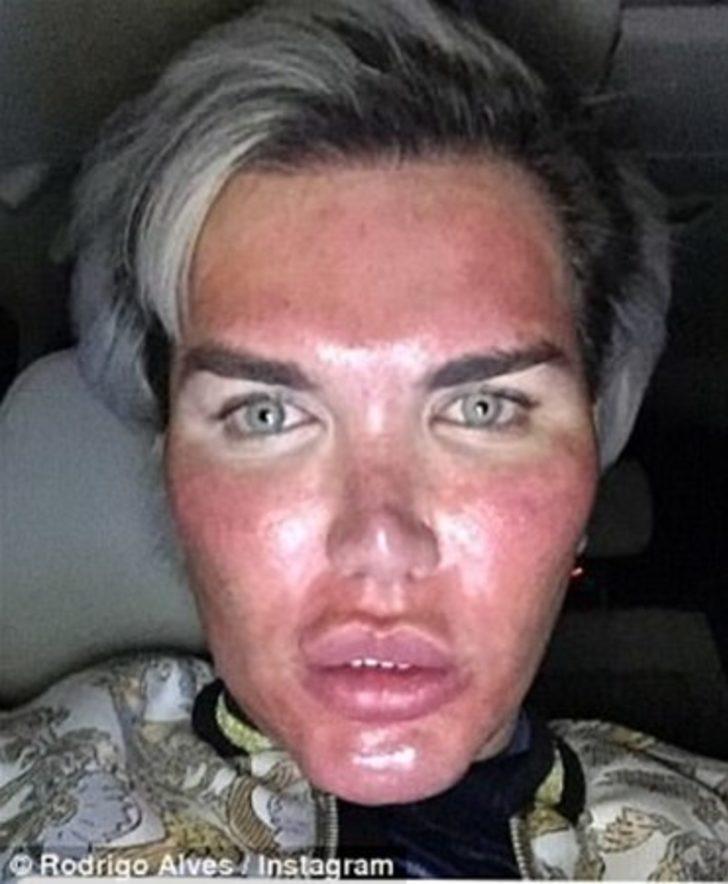 Doktorlar uyardı ama o bir kez daha ameliyat masasına yattı! İşte son hali G5