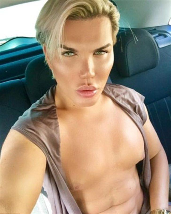 Rodrigo Alves yine ameliyat masasına yattı! Bakın bu kez ne yaptırdı? G1