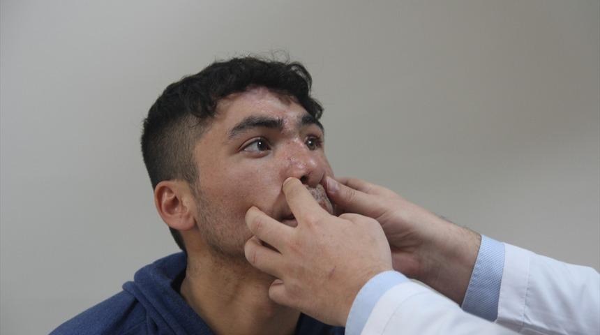 Dağılan yüzü vücudundaki parçalarla birleştirildi! Kendisi bile inanamadı