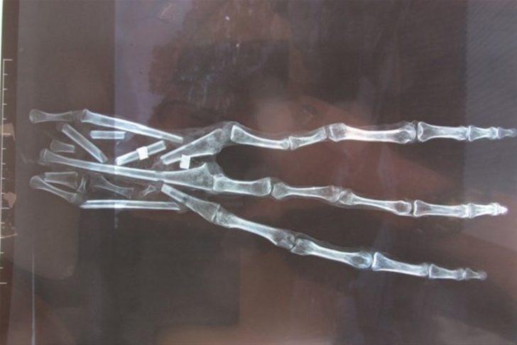 'Bulunan mumyalar uzaylı' G4