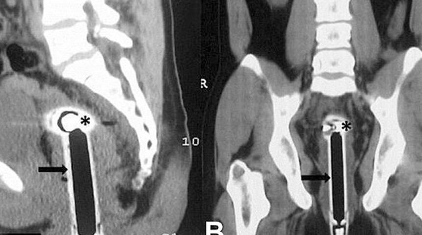 'Duşta kayıp &uuml;zerine d&uuml;şt&uuml;m' dedi! Ger&ccedil;ek ortaya &ccedil;ıkınca doktor bile inanmak istemedi