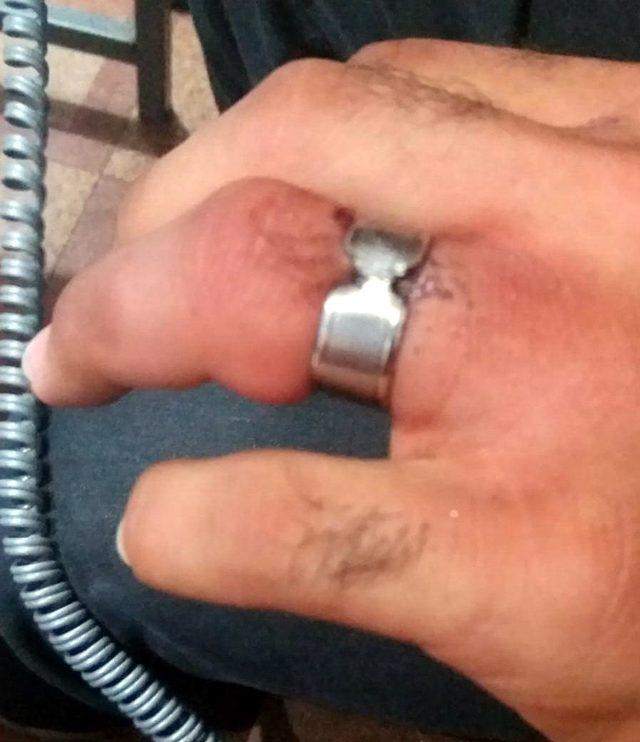 Parmağı sıkıştıran yüzüğü itfaiye çıkardı